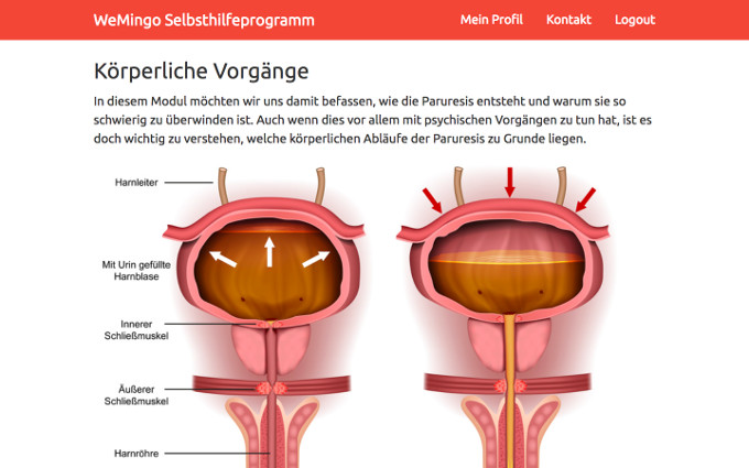 Screenshot from the WeMingo self-help program explaining the anatomy of the bladder